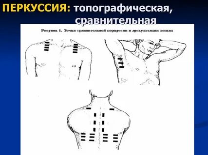 Топографическая перкуссия легких