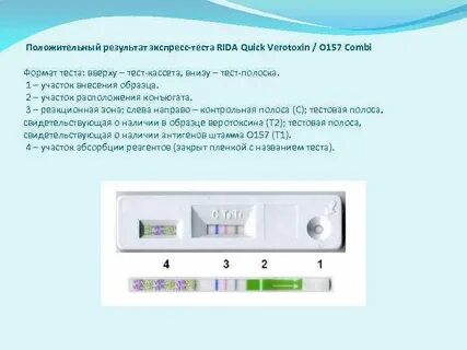 Результат экспресс теста