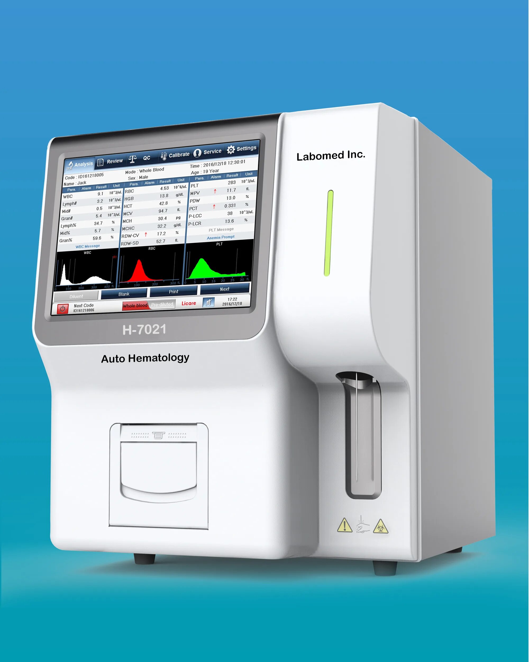 Kx-21n автоматический гематологический анализатор. Дискавери аппарат для камней. Гематологический анализатор sysmex kx-21. Анализатор элементный multi ea 5100 для определения хос analytik jena 2-31514. Анализатор 21.