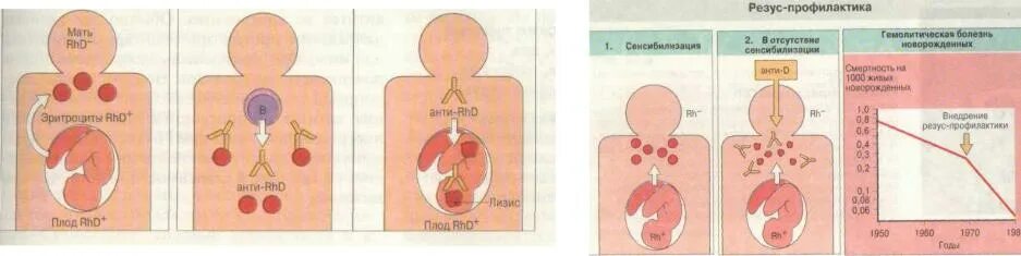 Гемолитическая болезнь плода резус конфликт. Беременность резус конфликт профилактика. Резус-Изоиммунизация гемолитическая болезнь плода. Беременность резус отрицательной матери
