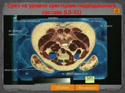 Уровень среза
