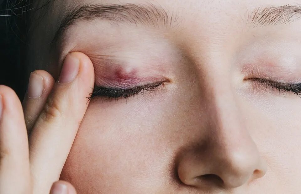 Подергивание бровей. Дергается бровь. Закрытый глаз. Зажмурившиеся глаза. Закрытый глаз.