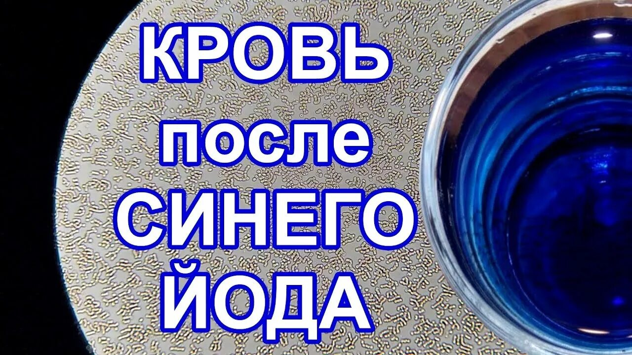 Синий йод применение. Синий йод. Приготовление йода. Синий йод рецепт. Как приготовить синий йод в домашних условиях.