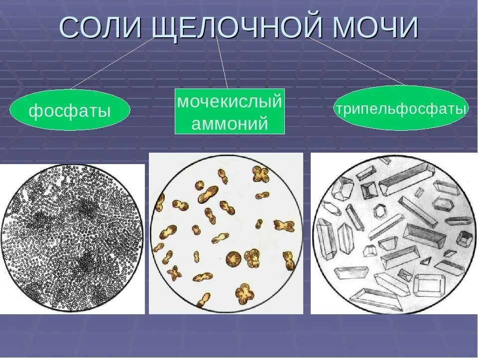 Фосфаты в моче у ребенка. Микроскопия мочи соли. микроскопия мочи трипельфосфаты. соли кислой мочи микроскопия. микроскопия мочи фосфаты.