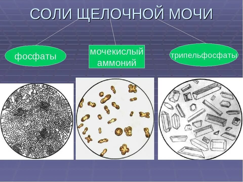 Фосфаты в какой моче. Микроскопия осадка мочи трипельфосфаты. Фосфаты в моче микроскопия. Микроскопия мочи трипельфосфаты. Соли в моче.