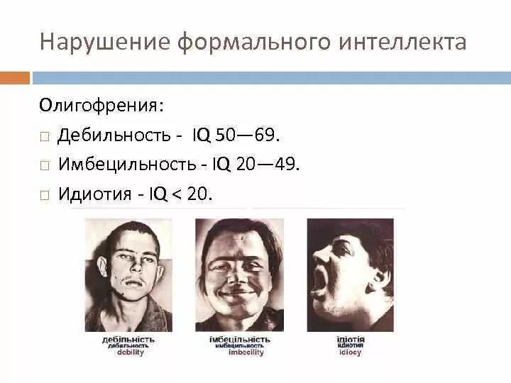 Степени умственной отсталости олигофрения. Имбецильность это степень умственной отсталости. Умственная отсталость дебильность Имбецильность идиотия. Степени умственной отсталость дебильность идиотия.