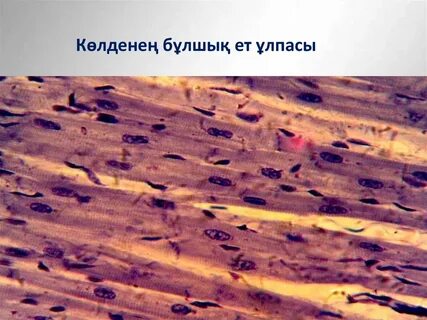 Пискадағы сиықты қараңыз