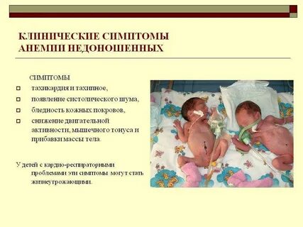 Инфекции недоношенных новорожденных