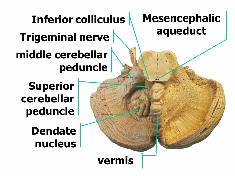 Colliculus superior. Colliculus inferior. inferior cerebellar peduncle. colliculus inferior перевод.
