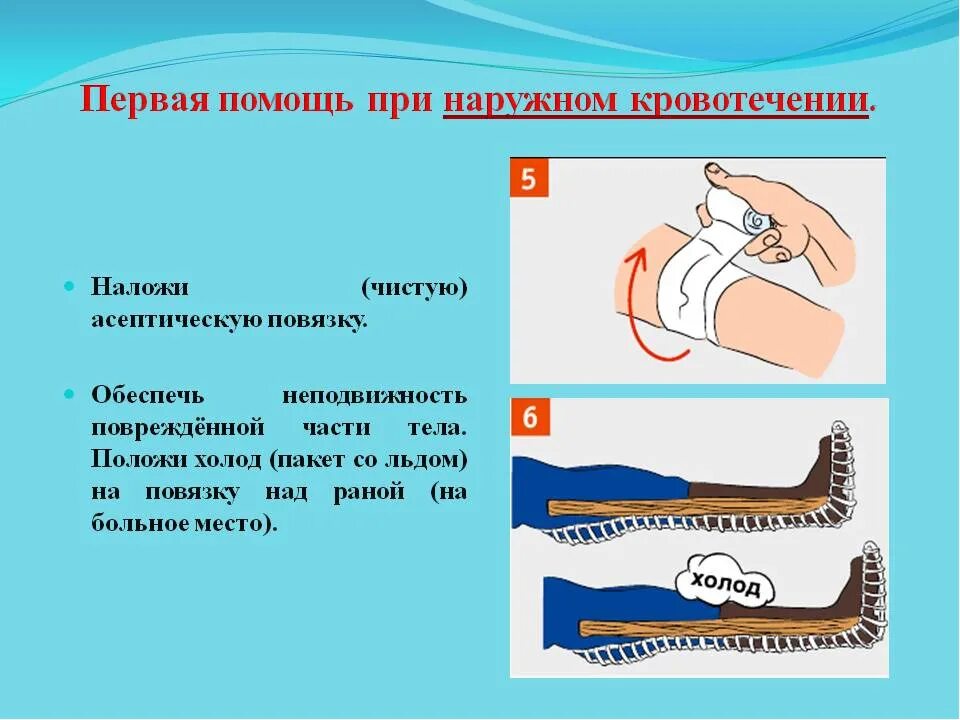 Оказание первой помощи остановки наружного кровотечения. Этапы оказания первой помощи при наружных кровотечениях. последовательные этапы первой помощи при наружном кровотечении. алгоритм оказания первой помощи при наружном кровотечении. памятка оказания первой помощи при наружном кровотечении.