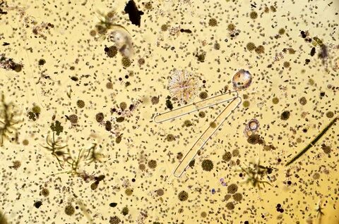 Морская вода под микроскопом