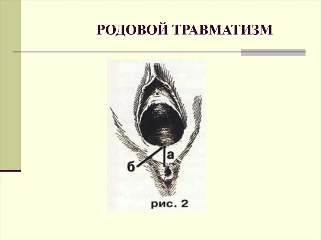 Международный день по искоренению акушерских свищей