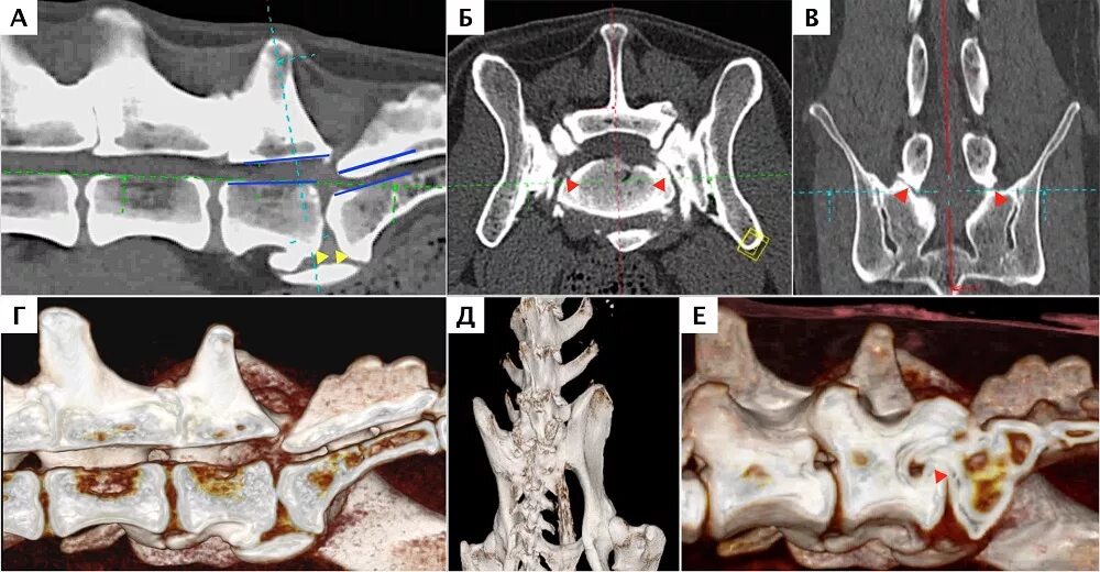 Рентген крестцового отдела позвоночника подготовка. Транспедикулярная фиксация позвоночника на кт. Кт крестцового отдела позвоночника. Кт пояснично-крестцового отдела собаки. МСКТ пояснично-крестцового отдела.