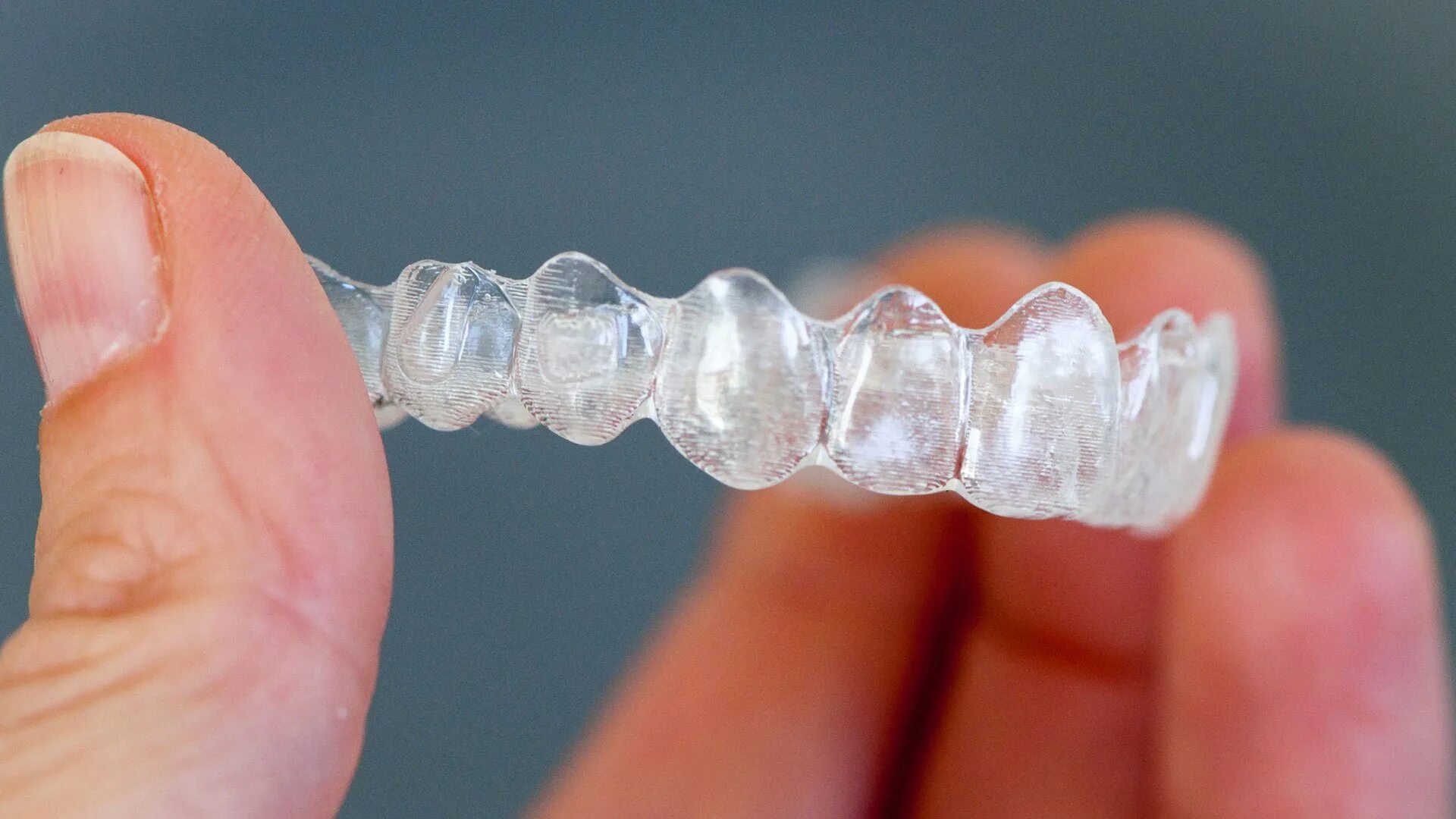 Invisalign. Элайнеры инвизилайн. элайнеры invisalign. элайнеры (каппы) инвизилайн (invisalign).