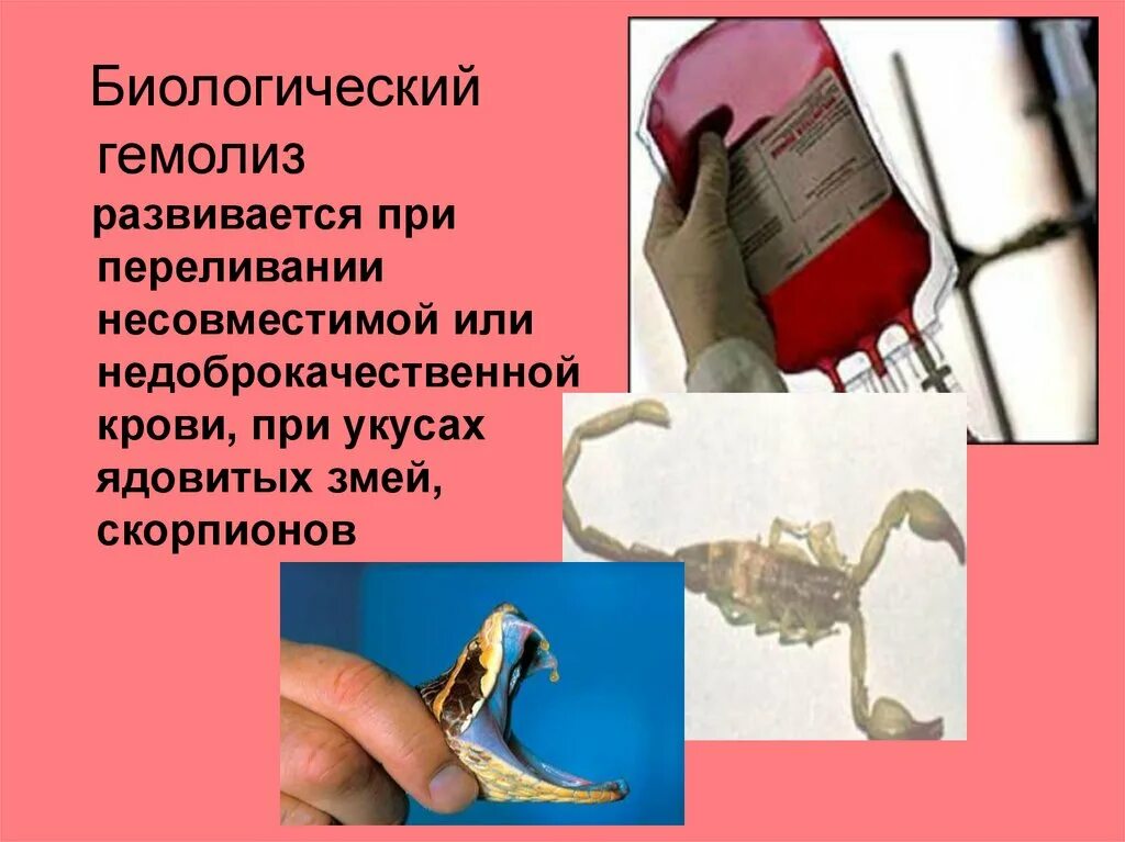 Виды и причины гемолиза. Химический гемолиз эритроцитов. Гемолиз физиология. Гемолиз причины физиология. Причины осмотического гемолиза.