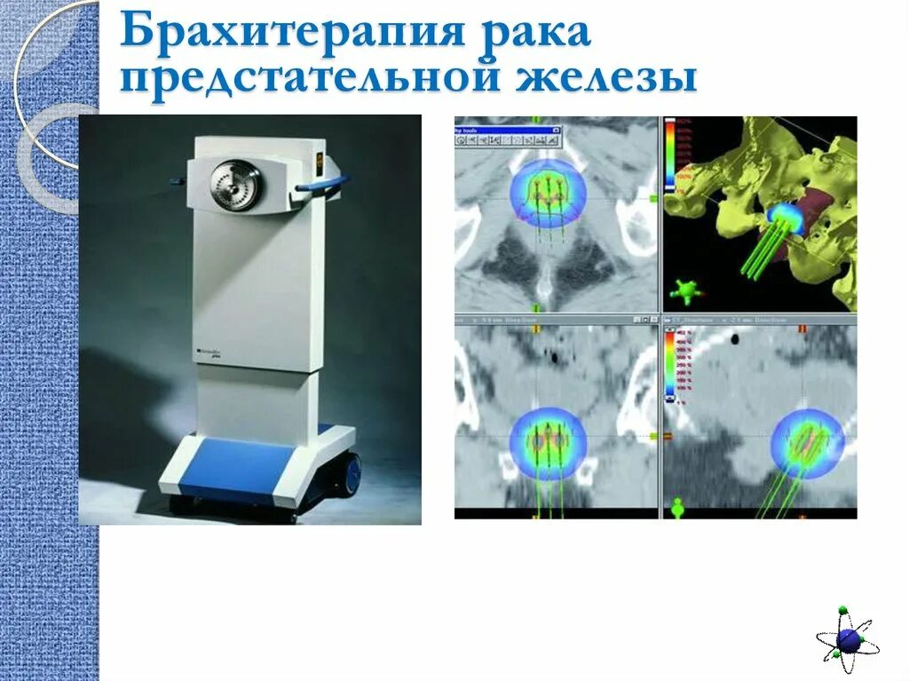 Брахитерапия простаты цена. Низкодозная брахитерапия. Контактная лучевая терапия брахитерапия это. Брахитерапевтический аппарат. Высокодозная брахитерапия предстательной железы.