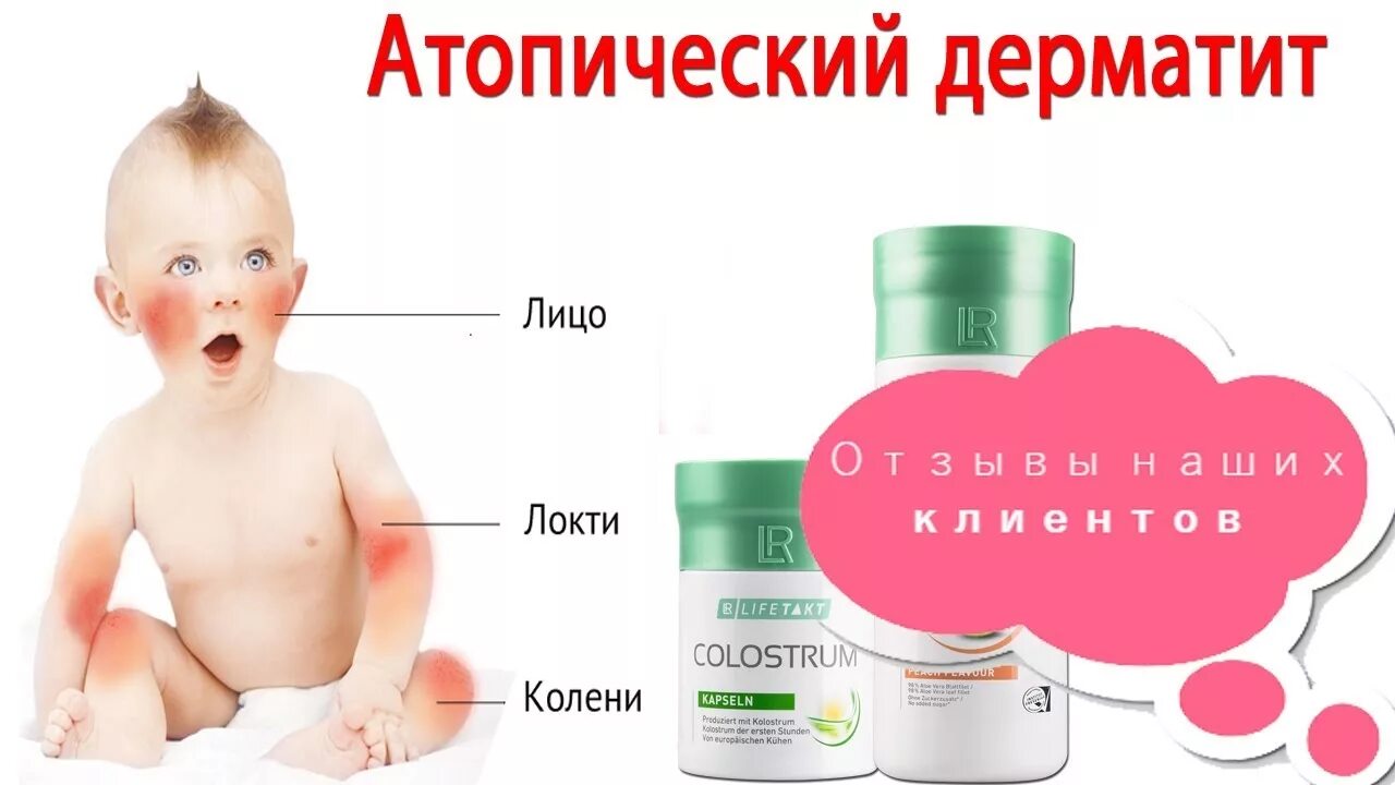 Почему у ребенка дерматит. Алоэ при атопическом дерматите.