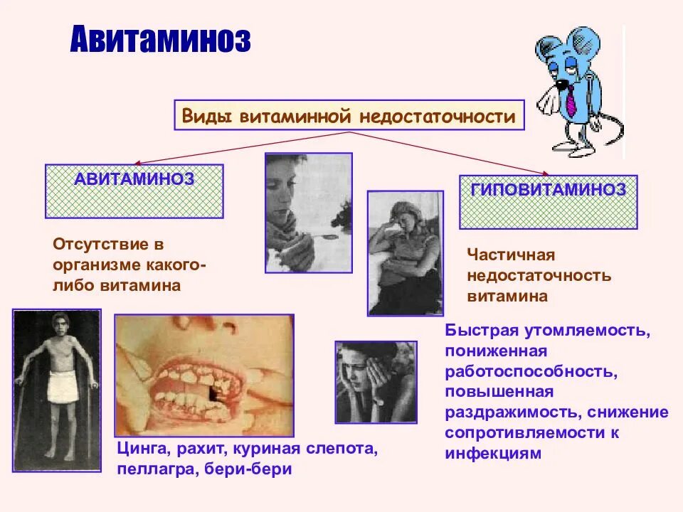 Авителлиноз. Цинга (дефицит витамина с). Признаки авитаминоза характерны для