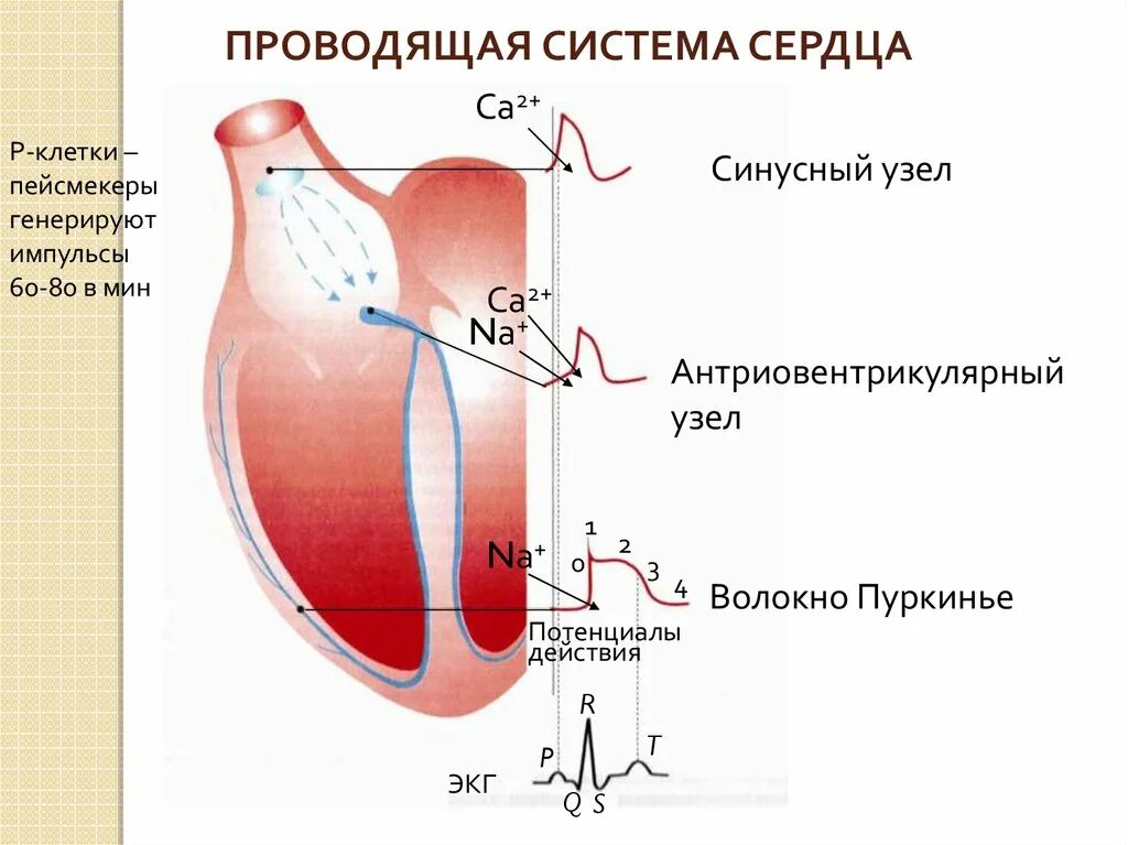 Пейсмекер