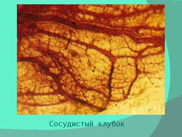 Капилляры гистология препарат. Микроциркуляторное русло гистология. микроциркуляторное русло гистология препарат. артериолы венулы капилляры препарат гистология. компоненты микроциркуляторного русла гистология.