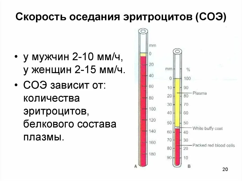 Повышено соэ по панченкову в крови