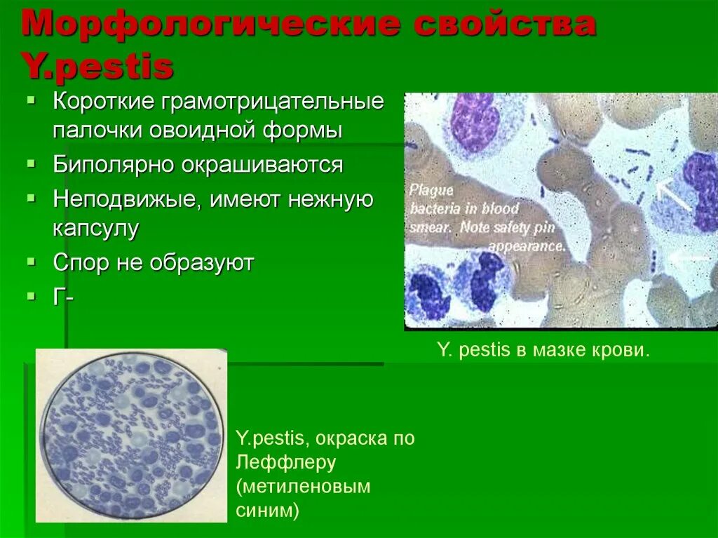 Овоидной формы что это. Грамотрицательные палочки. овоидная палочка. палочки овоидной формы. грамотрицательные палочки, овоидной формы, окрашиваются биполярно..