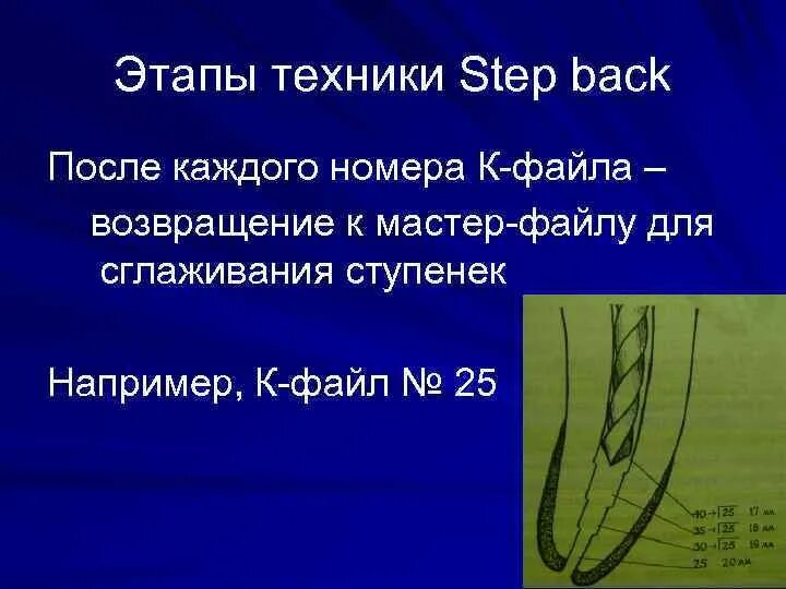 Step method. Степ бэк обработка корневых каналов. Методика Step back. Методики обработки корневых каналов Step back. Техника прохождения корневых каналов Step back.