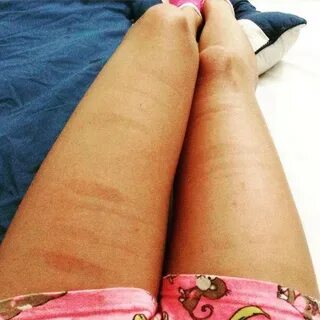 Красные ляжки