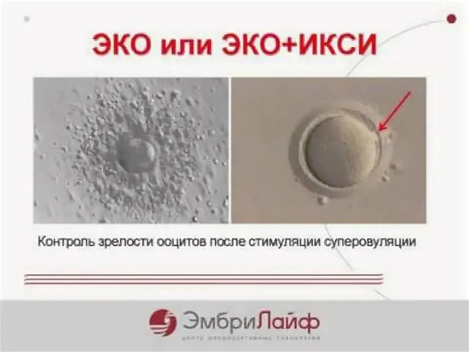 Эко икси форум. Эко икси. эко или икси. эко и икси разница. этапы икси.