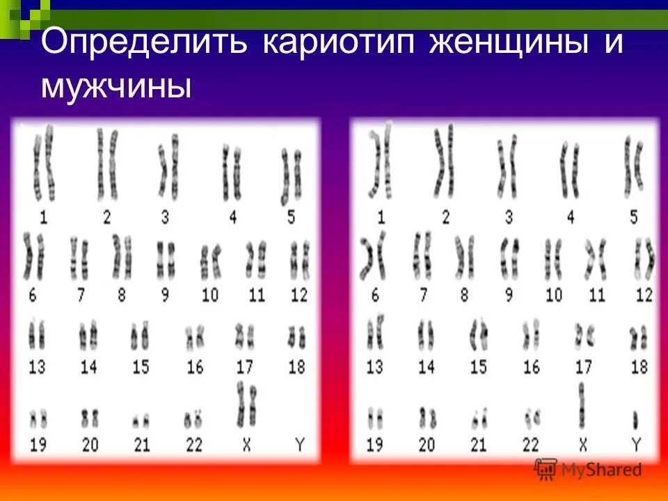 кариотип женщины. нормальный кариотип женщины 46 хх. кариотип здоровой женщины. кариотип женщины. нормальный кариотип мужчины и женщины.