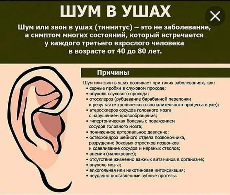 Жужжание в ухе