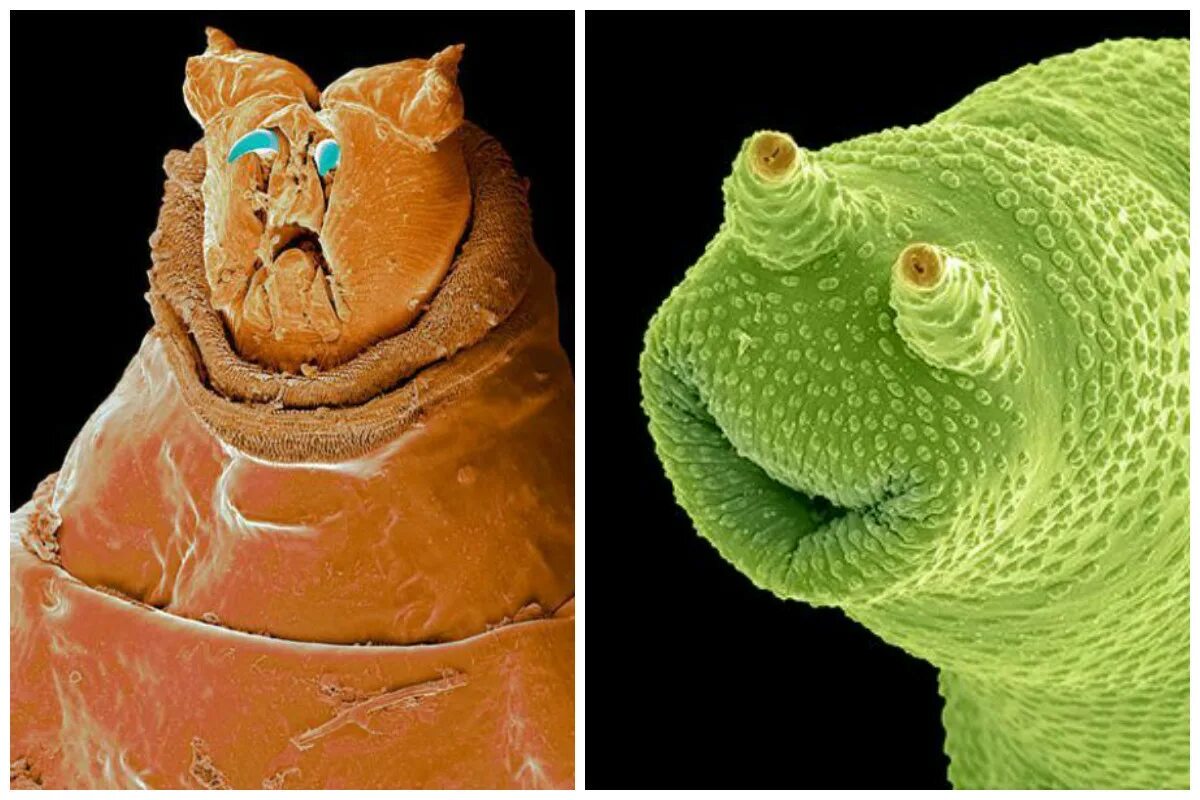 Бактерии на мухе. Морская полихета Nereis sandersi под электронным микроскопом. Личинка коловратки под микроскопом. Микроб Коловратка.