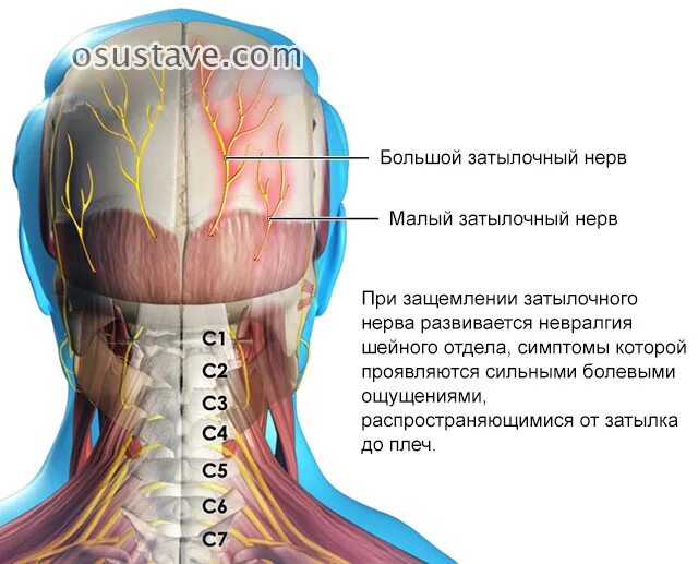 Защемило правую сторону шеи что делать. Невралгия затылочного нерва. Затылочный нерв иннервация.