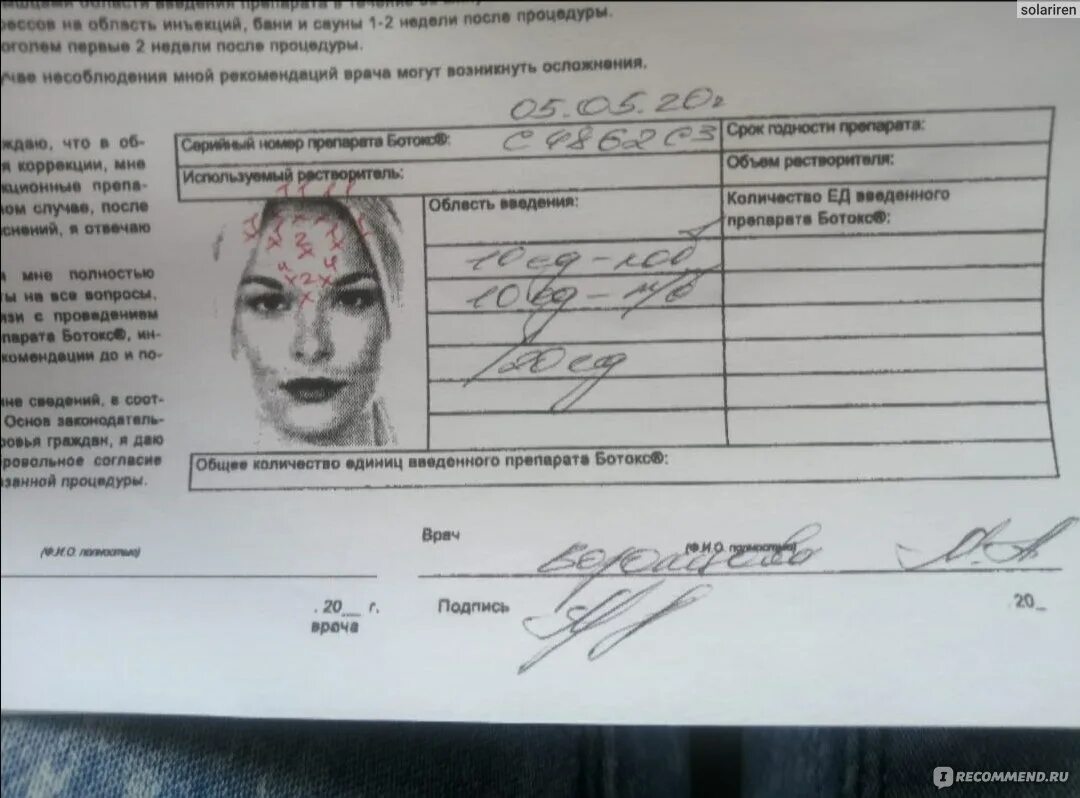 Сколько ботокса нужно в лоб. Сколько ботокса нужно в лоб