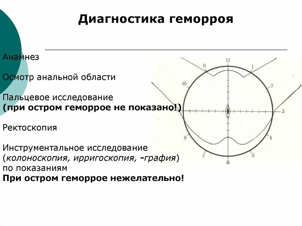Анатомия геморроя - Проктолог в Ростове-на-Дону