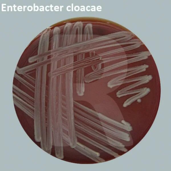 Enterobacter cloacae что это
