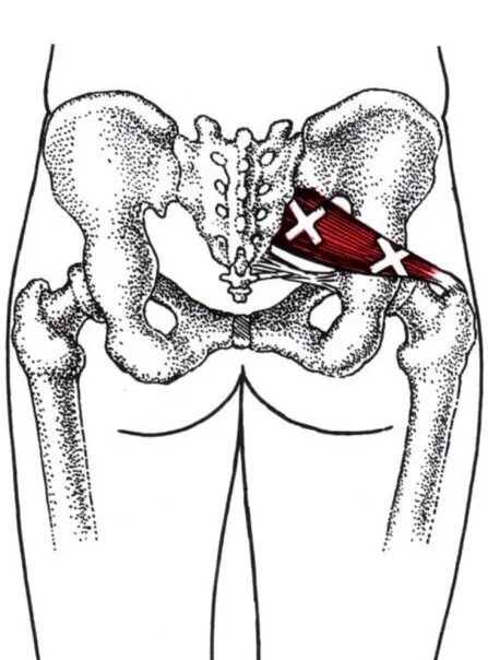 Грушевидной мышцы форум. Грушевидная мышца m. piriformis. анатомия грушевидной мышцы топографическая. пир грушевидной мышцы. мфр грушевидной мышцы.