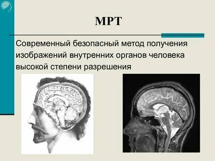 Институт мозга человека ран санкт петербург