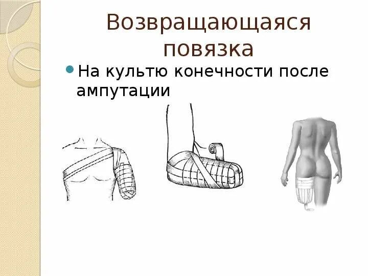 Наложение повязки на культю алгоритм. Повязка на культю после ампутации конечности. повязка на культю перевязки.