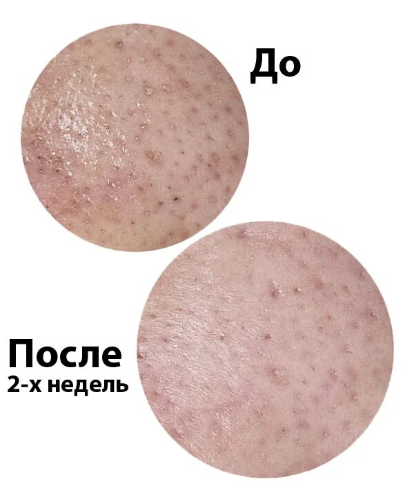 Manyo blackhead pore. Manyo Blackhead & Pore Cream. Manyo Blackhead Pore Toner. Manyo Toner от черных точек. Manyo крем против черных точек.