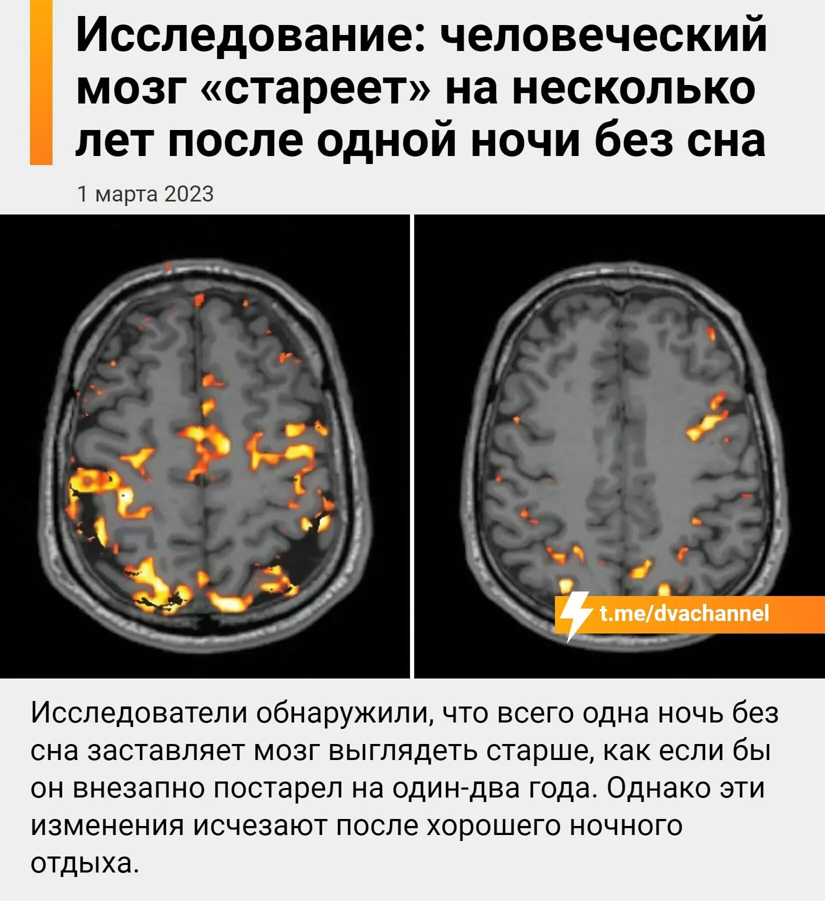 Вижу слева