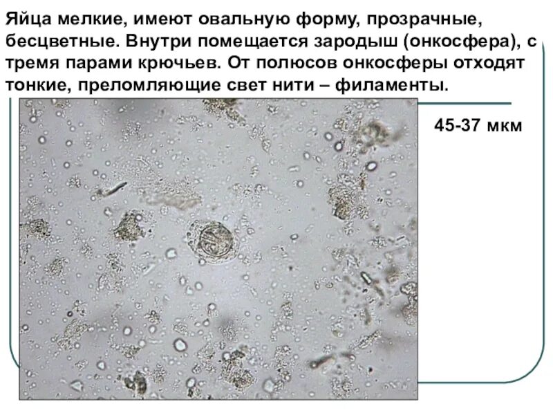 Большие имеют мелких. Яйца гельминта овальной формы прозрачные бесцветные. Мелкие яйца. Яйцо с онкосферой гельминт. Яйца глистов овальной формы.