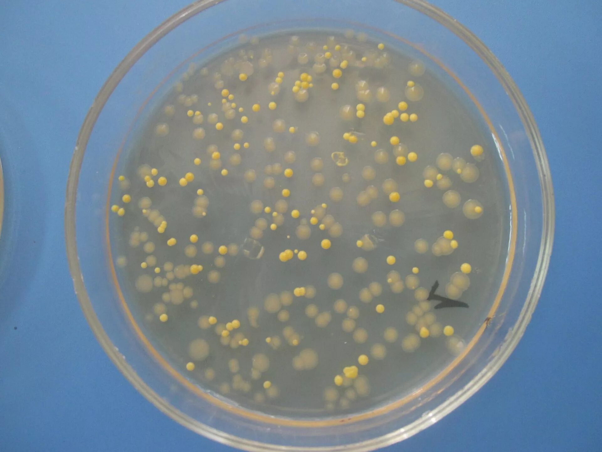Лактобациллы палочки дедерлейна. Гарднереллы (gardnerella vaginalis). Матрикс биопленки. Сферические микроорганизмы. Колония микроорганизмов это.