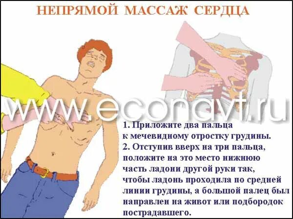 При непрямом массаже сердца пальцы располагаются. Непрямой массаж сердца положение рук. непрямой массаж сердца два пальца. два пальца от массаж сердца. непрямой массаж сердца руки располагаются граница.