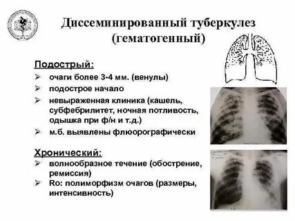 Туберкулез легких типы