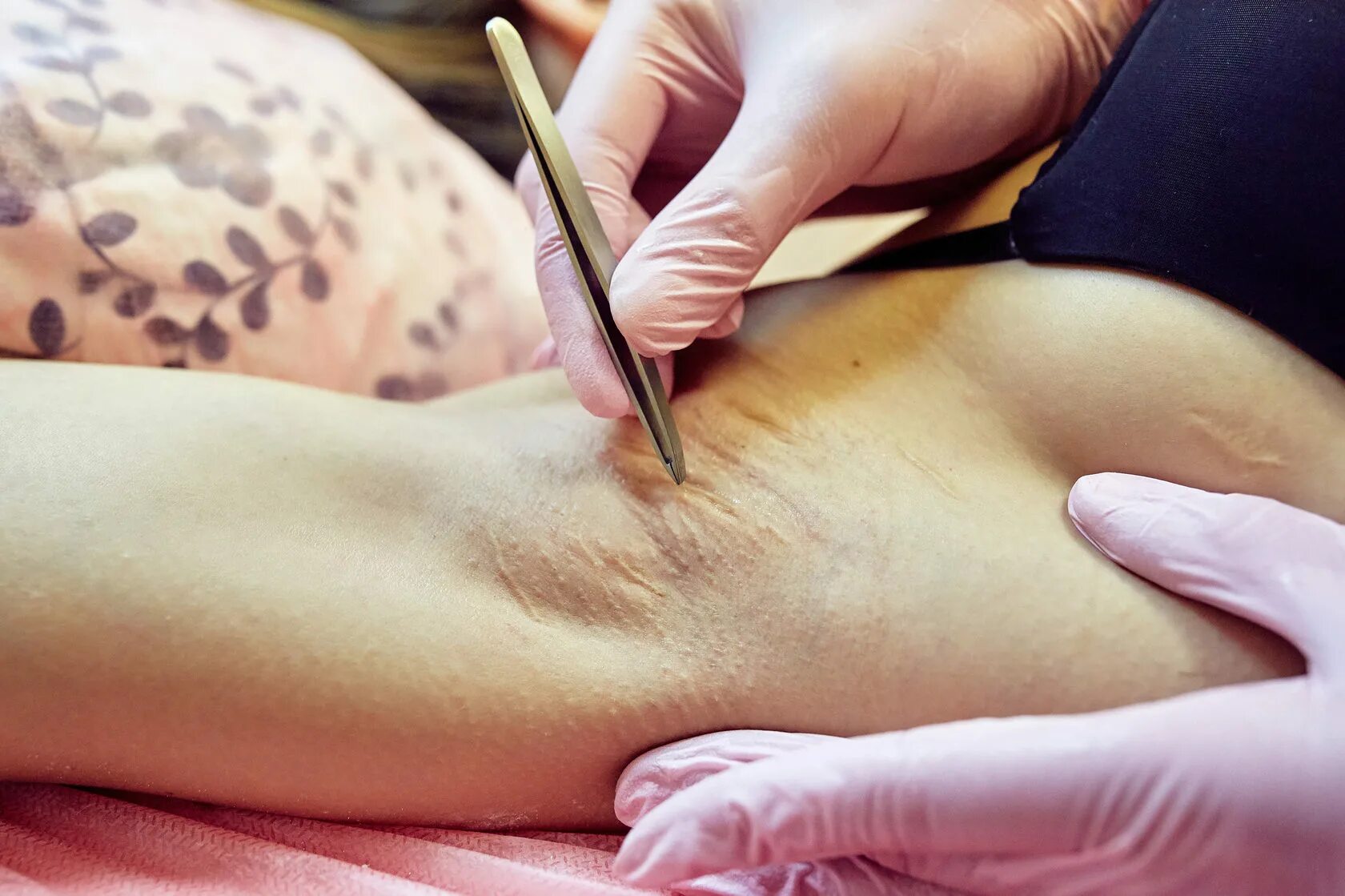 шугаринг бикини видео женщинам. шугаринг бикини видео женщинам. шугаринг бикини видео женщинам. мужская депиляция бикини. шугаринг глубокое бикини.