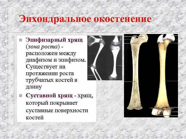 Рост трубчатых костей в толщину. Эпифизарный хрящ. Эпифизарный хрящ в трубчатой кости. Зона роста трубчатых костей. Эпифизарные зоны роста костей.