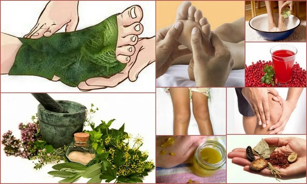 Избавление от псориаза. Солевая ванночка для ног. Фитотерапия. Народное средство от гр бка. Боль в суставах мазь.