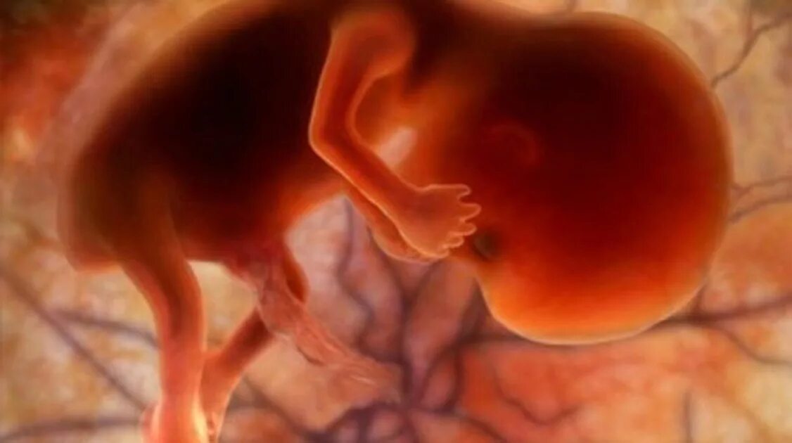 На 11 неделе тянет. Эмбрион на 11 неделе беременности. Эмбрион на 11 неделе беременности фото. Плод нв 11 недель беременности. 10-11 Недель беременности фото плода.