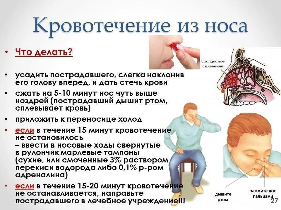 Кровь из носа просто так почему